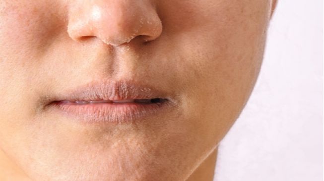 4 Kebiasaan yang Menyebabkan Bibir Terasa Kering dan Pecah-pecah